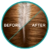 Picture of L'Oréal Paris Magic Retouch Golden Brown